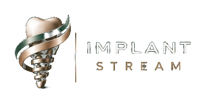 Implant Stream
